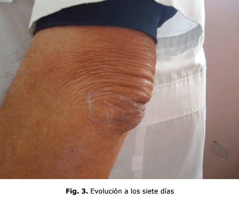 Fig. 3. Evolución a los siete días