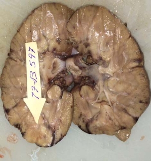 F:\PUB\foto ranatomia renal.JPG