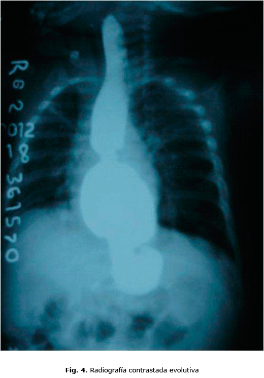 Fig. 4. Radiografía contrastada evolutiva