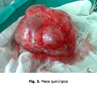 Fig. 3. Pieza quirúrgica