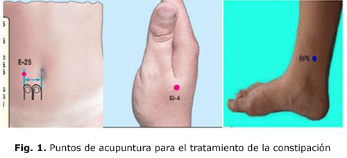 Fig. 1. Puntos de acupuntura para el tratamiento de la constipación