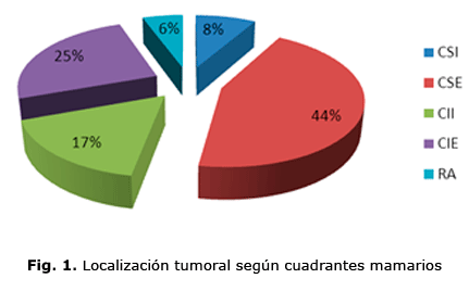 Fig. 1. Localización tumoral según cuadrantes mamarios