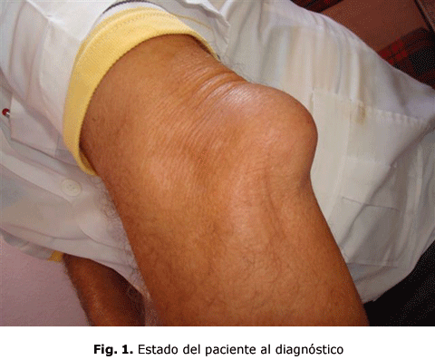 Fig. 1. Estado del paciente al diagnóstico