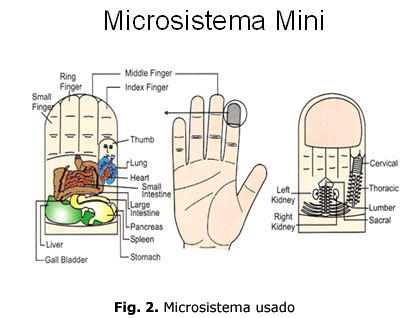 Fig. 2. Microsistema usado
