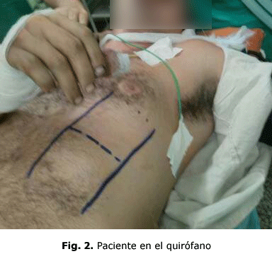 Fig. 2. Paciente en el quirófano