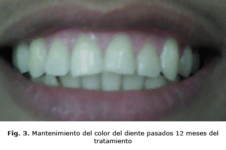 Fig. 3. Mantenimiento del color del diente pasados 12 meses del tratamiento